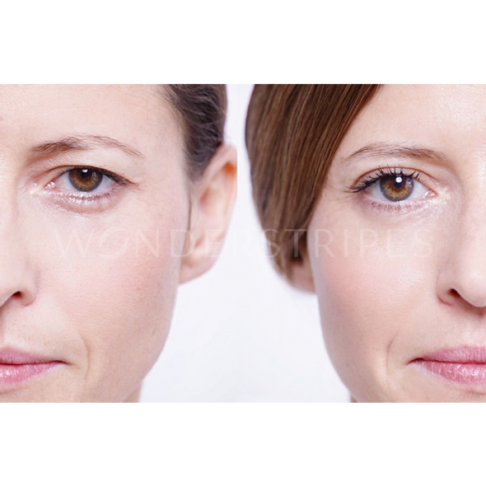 MAGICSTRIPES AUGENLID LIFTING - MEDIUM (M) / 64 STREIFEN