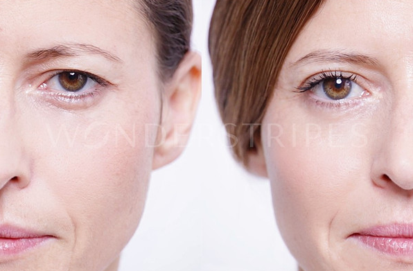 (S+M+L) Wonderstripes - Das erste Augenlid-Lifting Tape Pflaster